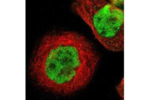 Immunofluorescent staining of A-431 cells with ZBTB7B polyclonal antibody  (Green) shows positivity in nucleus but excluded from the nucleoli.