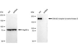 Western blotting analysis using Erb-b2 receptor tyrosine kinase 2 antibody (ABIN7800156).