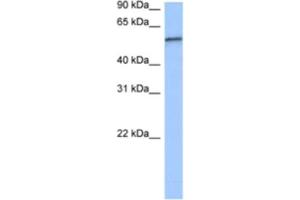 Western Blotting (WB) image for anti-RNA Pseudouridylate Synthase Domain Containing 2 (RPUSD2) antibody (ABIN2462339) (RPUSD2 Antikörper)