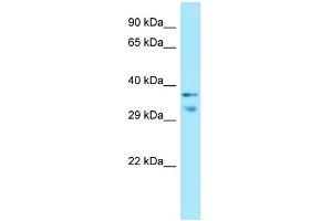 WB Suggested Anti-MRGPRX1 Antibody Titration: 1. (MRGPRX1 Antikörper  (C-Term))