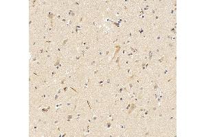 anti-RAB3 GTPase Activating Protein Subunit 2 (Non-Catalytic) (RAB3GAP2) (AA 1-115) antibody