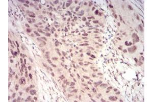 Immunohistochemistry (IHC) image for anti-Wilms Tumor 1 Associated Protein (WTAP) (AA 91-201) antibody (ABIN5542407)