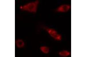 ABIN6274161 staining HepG2 cells by IF/ICC. (POLA1 Antikörper  (N-Term))