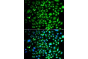 Immunofluorescence analysis of A549 cells using PTK6 antibody. (PTK6 Antikörper  (AA 222-451))