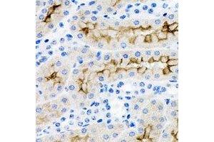 Immunohistochemical analysis of IRSp53 staining in rat kidney formalin fixed paraffin embedded tissue section. (BAIAP2 Antikörper)