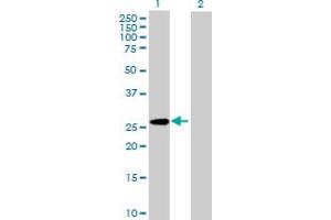Western Blot analysis of PAFAH1B3 expression in transfected 293T cell line by PAFAH1B3 MaxPab polyclonal antibody. (PAFAH1B3 Antikörper  (AA 1-231))
