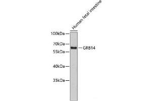 Western blot analysis of extracts of Human fetal intestine using GRB14 Polyclonal Antibody. (GRB14 Antikörper)