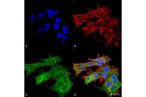 Immunocytochemistry/Immunofluorescence analysis using Mouse Anti-Versican Monoclonal Antibody, Clone S351-23 . (Versican Antikörper  (AA 362-585) (Biotin))