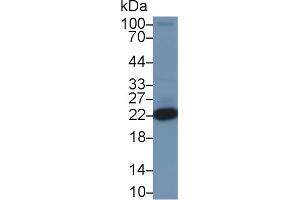 Detection of PARK7 in Rat Heart lysate using Polyclonal Antibody to Parkinson Disease Protein 7 (PARK7) (PARK7/DJ1 Antikörper  (AA 1-189))