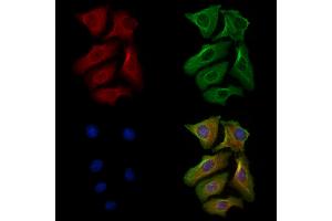 Phospho-Phospholamban (Ser16) Antibody staining Hela cells(heat shock treatment) by IF/ICC. (Phospholamban Antikörper  (pSer16))