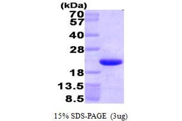 HMGN1 Protein (AA 1-100) (His tag)