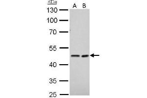 WB Image NDRG1 antibody detects NDRG1 protein by Western blot analysis. (NDRG1 Antikörper)