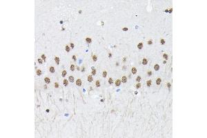 Immunohistochemistry of paraffin-embedded mouse brain using PTBP2 Rabbit pAb (ABIN6128372, ABIN6146373, ABIN6146374 and ABIN6221684) at dilution of 1:100 (40x lens). (PTBP2 Antikörper  (AA 1-280))