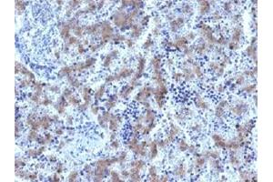 Immunohistochemical staining (Formalin-fixed paraffin-embedded sections) of human fetal liver with GPC3 recombinant monoclonal antibody, clone GPC3/1534R . (Rekombinanter Glypican 3 Antikörper)