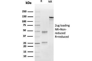 SDS-PAGE Analysis Purified UBE2C Mouse Monoclonal Antibody (CPTC-UBE2C-1). (UBE2C Antikörper)