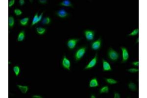 Immunofluorescence staining of A549 cells with ABIN7154600 at 1:166, counter-stained with DAPI. (RIT2 Antikörper  (AA 1-150))