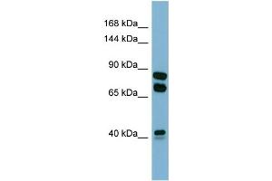 Host:  Rabbit  Target Name:  PXDN  Sample Type:  COLO205 Whole cell lysates  Antibody Dilution:  1. (Peroxidasin Antikörper  (N-Term))