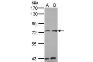 Image no. 2 for anti-Pumilio RNA Binding Family Member 3 (PUM3) (AA 415-648) antibody (ABIN1499029) (KIAA0020 Antikörper  (AA 415-648))