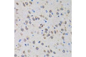 Immunohistochemistry (Paraffin-embedded Sections) (IHC (p)) image for anti-Progesterone Receptor Membrane Component 1 (PGRMC1) (AA 44-195) antibody (ABIN6145520)