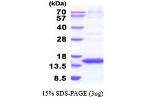 SDS-PAGE (SDS) image for Cystatin E/M (CST6) (AA 29-149) (Active) protein (His tag) (ABIN5777825) (CST6 Protein (AA 29-149) (His tag))