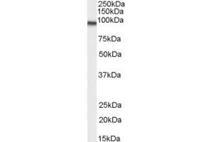 Western Blotting (WB) image for anti-Ankyrin Repeat Domain 18B (ANKRD18B) (C-Term) antibody (ABIN2791452) (ANKRD18B Antikörper  (C-Term))