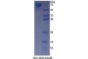 SDS-PAGE (SDS) image for Farnesyl Diphosphate Synthase (FDPS) (AA 1-353) protein (His tag,GST tag) (ABIN6237332) (FDPS Protein (AA 1-353) (His tag,GST tag))