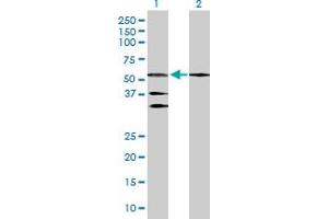 Lane 1: RARB transfected lysate ( 50. (RARB 293T Cell Transient Overexpression Lysate(Denatured))