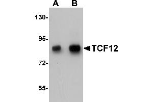 Western Blotting (WB) image for anti-Transcription Factor 12 (TCF12) (N-Term) antibody (ABIN1031604)