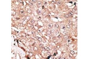 Immunohistochemistry (IHC) image for anti-Lysine (K)-Specific Demethylase 1A (KDM1A) (AA 819-852) antibody (ABIN3031653)