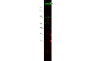 Western blot using  Affinity Purified anti-Nestin antibody shows detection of a band ~220 kDa corresponding to mouse Nestin (arrowhead). (Nestin Antikörper  (AA 1484-1500))