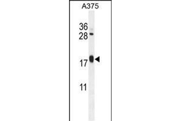 ARL8A 抗体  (AA 116-142)