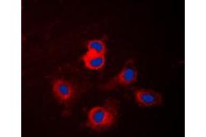 Immunofluorescent analysis of Cytochrome P450 17A1 staining in NIH3T3 cells. (CYP17A1 Antikörper  (Center))