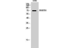 Western Blotting (WB) image for anti-rho-Related BTB Domain Containing 3 (RHOBTB3) (Internal Region) antibody (ABIN3177218) (RHOBTB3 Antikörper  (Internal Region))