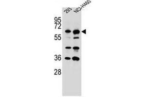 CKAP4 Antibody (C-term) western blot analysis in 293,NCI-H460 cell line lysates (35µg/lane).