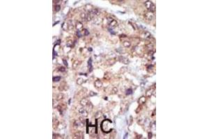 Immunohistochemistry (IHC) image for anti-V-Yes-1 Yamaguchi Sarcoma Viral Related Oncogene Homolog (LYN) antibody (ABIN3003450)
