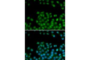 Immunofluorescence (IF) image for anti-Secreted Frizzled-Related Protein 2 (SFRP2) antibody (ABIN1876571) (SFRP2 Antikörper)