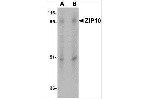 Western blot analysis of ZIP10 in human spleen tissue lysate with ZIP10 antibody at (A) 1 and (B) 2 μg/ml. (SLC39A10 Antikörper  (Center))