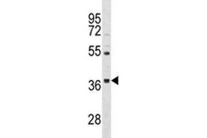 ORAI3 antibody western blot analysis in HepG2 lysate. (ORAI3 Antikörper  (AA 1-30))