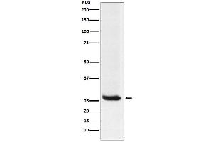 Western blot analysis of Hippocalcin expression in Neuro2a cell lysate.