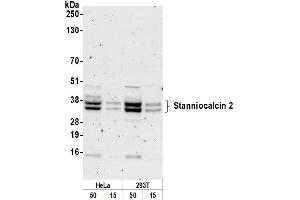 anti-Stanniocalcin 2 (STC2) (AA 252-302) antibody