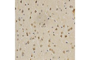Immunohistochemistry of paraffin-embedded mouse brain using HDAC6 antibody (ABIN5997884) at dilution of 1/100 (40x lens). (HDAC6 Antikörper)