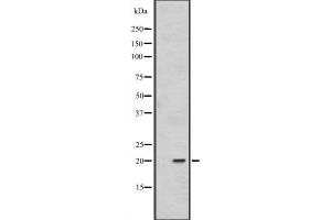 Western blot analysis of FAIM1 expression in 293T whole cell lysate ,The lane on the left is treated with the antigen-specific peptide. (FAIM Antikörper  (Internal Region))