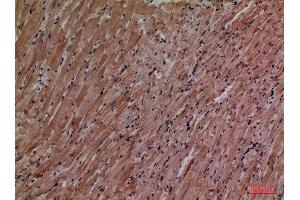 Immunohistochemistry (IHC) analysis of paraffin-embedded Mouse Heart, antibody was diluted at 1:100. (P2RX3 Antikörper  (Internal Region))