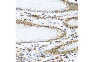 Immunohistochemistry of paraffin-embedded human stomach using IFI44 antibody at dilution of 1:100 (40x lens). (IFI44 Antikörper)