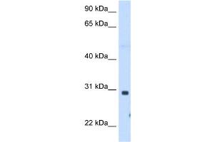 ST3GAL3 antibody used at 1. (ST3GAL3 Antikörper  (C-Term))