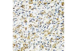 Immunohistochemistry (Paraffin-embedded Sections) (IHC (p)) image for anti-Heat Shock 70kDa Protein 9 (Mortalin) (HSPA9) (AA 380-679) antibody (ABIN3021000)