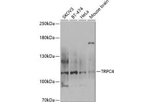 Western blot analysis of extracts of various cell lines, using TRPC4 antibody (ABIN6128868, ABIN6149576, ABIN6149577 and ABIN6222763) at 1:1000 dilution. (TRPC4 Antikörper  (AA 768-977))