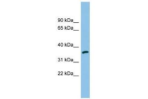 AKR1C2 antibody used at 1 ug/ml to detect target protein. (AKR1C2 Antikörper)