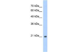 WB Suggested Anti-TSHR Antibody Titration:  1. (TSH receptor Antikörper  (N-Term))