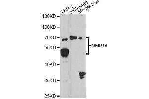 Western blot analysis of extracts of various cell lines, using MMP14 antibody. (MMP14 Antikörper)